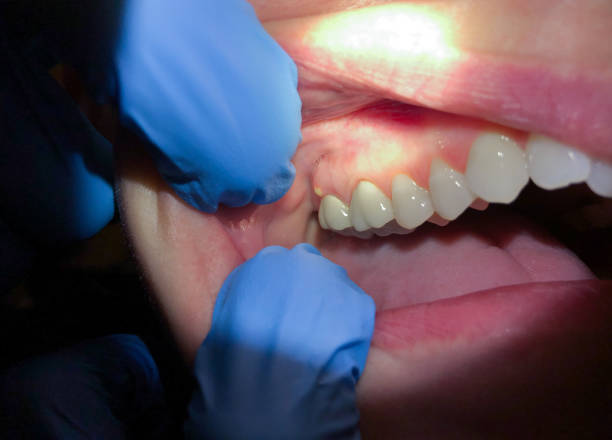 Best Cracked Tooth Emergency Dentist  in Weimar, TX