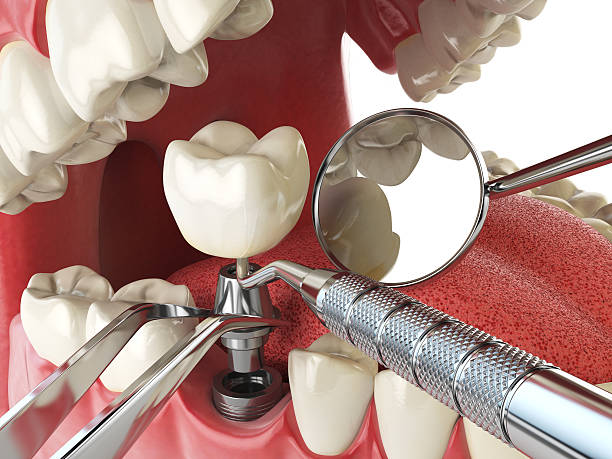 Dentist for Dental Trauma in TX